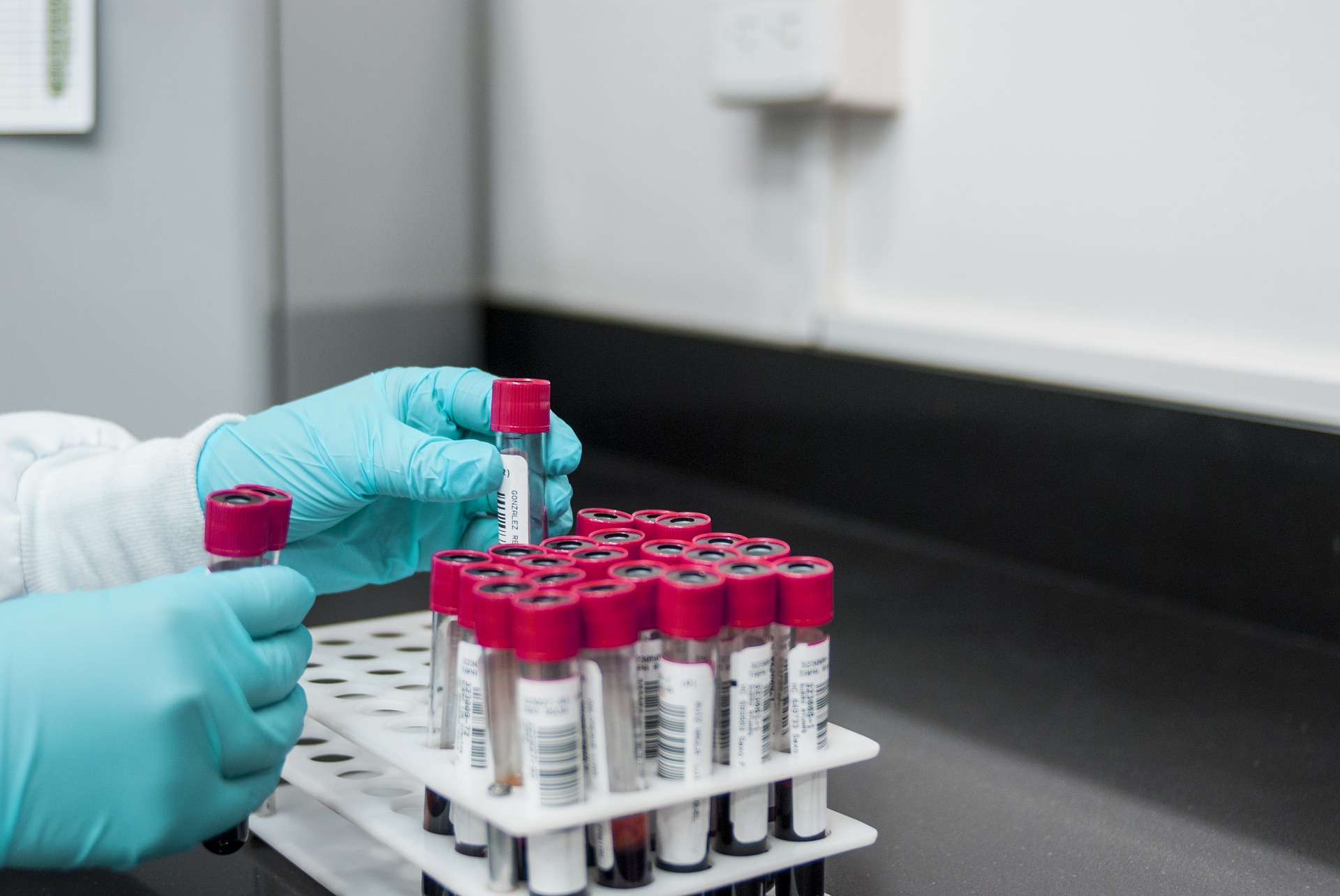 Studie identifiziert „Schwachstellen“ im Kras-Protein